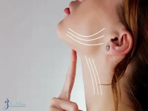 جراحی لیفت گردن