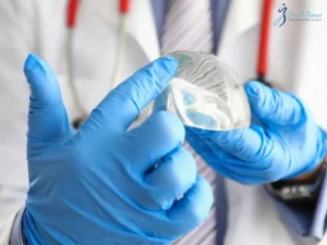 شیردهی بعد از پروتز سینه