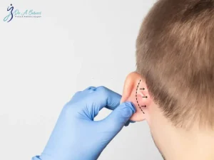 مراقبت های بعد از اتوپلاستی