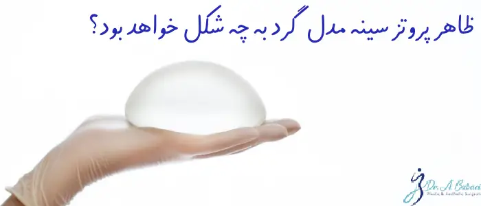 پروتز سینه مدل گرد

